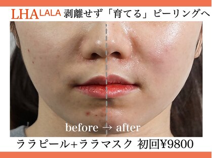 タプティムの写真