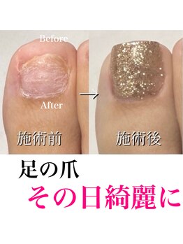 リリー/足も綺麗になる！