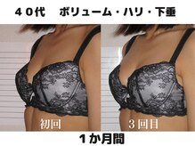 バストサロン メルベイユ(Merveile)/デコルテ～ボリュームUP・ハリUP