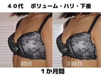 バストサロン メルベイユ(Merveile)/デコルテ～ボリュームUP・ハリUP