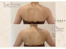 アンバー 恵比寿(AMBER)/自分ではケアしにくい二の腕にも