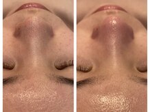 ビパール(bea pull)/あのmegumiさんがやってます！