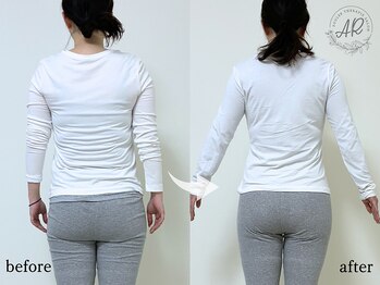 エーアール(AR)の写真/【ムダ肉、実は「歪んだ骨格」のせい】痩せにくい二の腕・知らぬ間に積もった背肉を撃退！