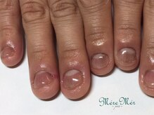 メールメール 和光市本店(MereMer)/（経過）110 深爪 深爪緩和 ケア