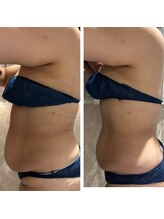 サロン ド スー(Salon de Suu)/ウルトランスフォーマー（全身）