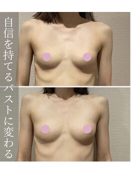 アーレ 博多本店(ARE)/痩せ型で太りにくい方もサイズUP