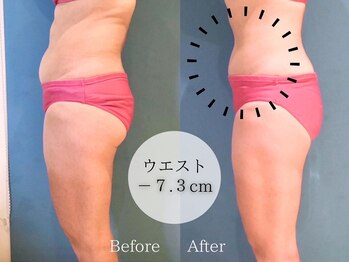 ピュアエステ ブリアント 松戸店/お客様の結果［松戸］