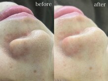 テオリア(TEORIA)/平日はとってもお得♪