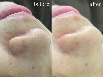 テオリア(TEORIA)/平日はとってもお得♪