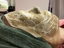 ヴィーナスハンドの雰囲気（大人気★ハーブピーリング（ハーバルシー）スピーディーな肌改善）