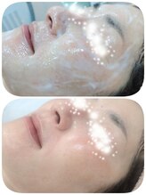 エタニティ 西宮店(Eternity)/コラーゲンパック/白玉美肌