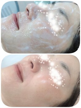 エタニティ 西宮店(Eternity)/コラーゲンパック/白玉美肌