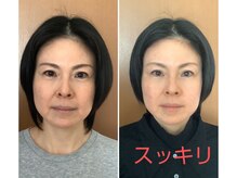 ビューティフルムーン(Beautiful Moon)/小顔デザイン&小顔全身矯正