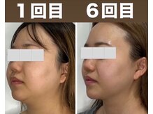 エミナル(EMINARU)の雰囲気（結果重視！速攻効果！小顔実感95%以上★吹田口コミNo.1サロン）