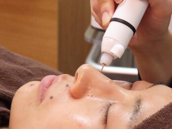 フェリス(feliz)の写真/シミ・しわケアでお肌のお悩み解消！当店自慢のトータルビューティーケアがおすすめ☆