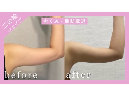 レイ(0 Lei)の写真