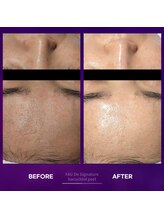 アムレット(Amourette)/FAUバクチオールピールハリツヤ