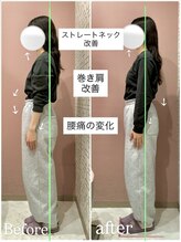 ユルル 刈谷店(Yururu)/変化(骨盤整体＆猫背整体)