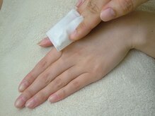 ソフィア イオン茅ヶ崎中央店(Sophia)/脱毛：手の甲脱毛￥1100（1回）