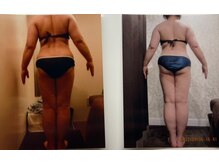 パーフェクトボディプレミアム 札幌駅前店(PERFECT BODY PREMIUM)/お客様　ビフォーアフター（10）