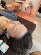 ハリファ鍼灸院 横浜関内院(HariFa鍼灸院)/美容鍼