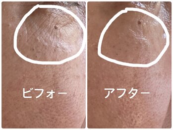 ノーブル シャット Noble Chate/目元のシワが目立たない!