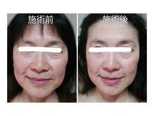 キラリ(Kirari)/お客様の変化☆