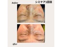 ビセラ(Vicella)の雰囲気（《最新光フェイシャル》最短でシミケア、たるみケア、毛穴にも◎）