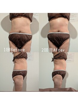 サロン ド モミカル(salon de momikaru)/