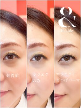 リンクプラスビューティー(RiMK plus beautY)/根元からグッと上がる&Herthy