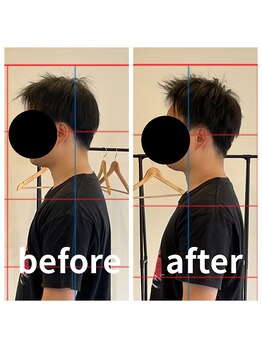 熊本カワル整体 JR上熊本駅院/デスクワークによる頭部の位置