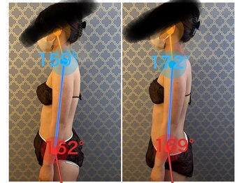 マイティー整骨院 ココア(CoCoa)/活性リンパ洗浄