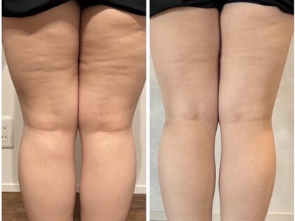 リコ(Lico)の写真