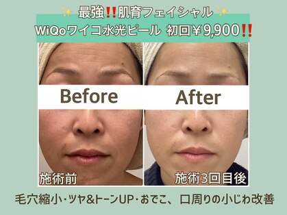 プティ カシェット 伊丹店(petit cachette)の写真