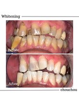 シュシュ(chouchou)/医療提携機関ジェル比較