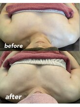 リラクゼーションエステ アジュール(Azur)/【施術4回】