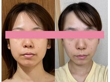 サロンドミジュ(Salon de 美jyu)/骨格・小顔矯正