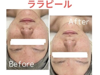 ライズ 岩見沢店(RISE)/【ララピール】ビフォーアフター