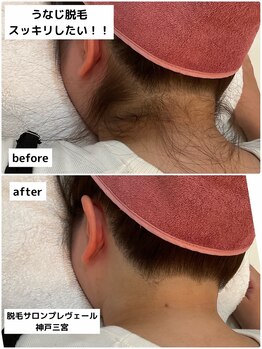 プレヴェール 神戸三宮/うなじ美人計画