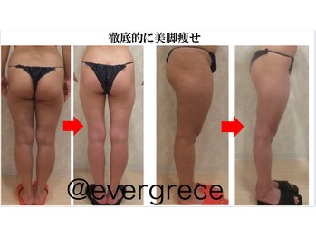 エヴァーグレース 河原町店/京都河原町の痩身エステサロン