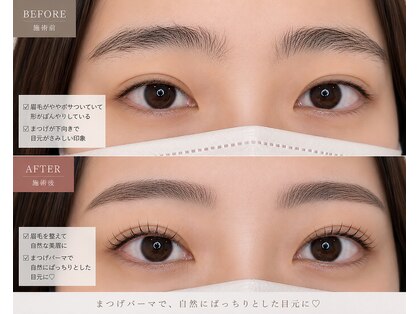 ウィラレア(UILALEA)の写真
