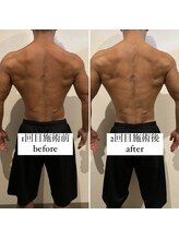 東京デトックス/【BA】インディバボディメイク60