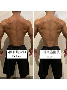 東京デトックス/【BA】インディバボディメイク60