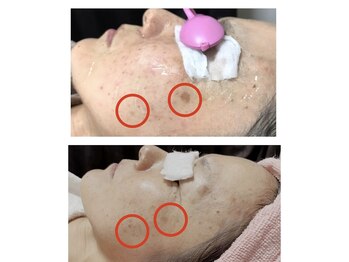 ファミリーセルフサロン 輪(Wa)/継続は力なり