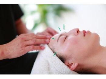 ザ タイム(The Time)/痛みの少ない優しい美容鍼