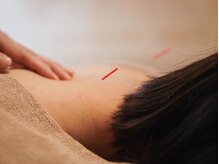 アルバ暁子鍼灸治療院(alba暁子鍼灸治療院)/自律神経の整え&疲労解消に◎