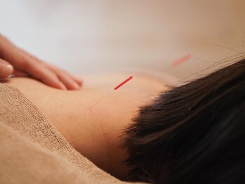 アルバ暁子鍼灸治療院(alba暁子鍼灸治療院)/自律神経の整え&疲労解消に◎