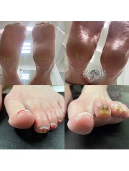 爪整体「足元からの健康」