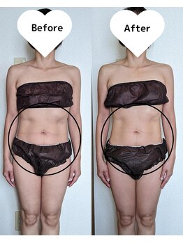 サロン ド ベルメール(Salon de Belle mer)/リンパマッサージ/痩身/リンパ