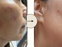 ビジュー(BIJOU)/